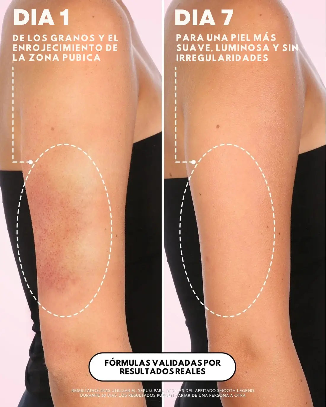 Original Truly Smooth Legend - Tu piel como la de un Bebe + Envio Gratís!